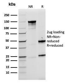 Anti-LMO2 Mouse Recombinant Antibody [clone: rLMO2/1971]