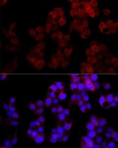 Immunofluorescence analysis of HepG2 cells using Anti-NUDT5 Antibody [ARC2525] (A307291) at a dilution of 1:100 (40X lens). DAPI was used to stain the cell nuclei (blue)