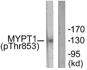 Western blot analysis of lysates from NIH/3T3 cells using Anti-MYPT1 (phospho Thr853) Antibody. The right hand lane represents a negative control, where the Antibody is blocked by the immunising peptide