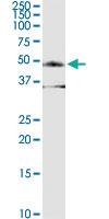 Anti-FOXP3 Rabbit Polyclonal Antibody