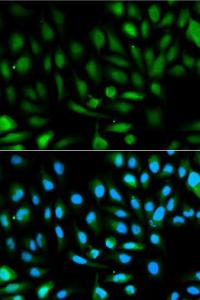 Immunofluorescence analysis of HeLa cells using Anti-PARK7 / DJ1 Antibody (A12745). DAPI was used to stain the cell nuclei (blue).