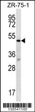 Anti-TBL2 Rabbit Polyclonal Antibody