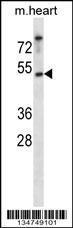 Anti-CSNK1E Rabbit Polyclonal Antibody (AP (Alkaline Phosphatase))