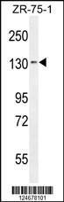 Anti-TLL1 Rabbit Polyclonal Antibody (HRP (Horseradish Peroxidase))