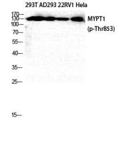 Western blot analysis of 293T AD293 22RV1 HELA cells using Anti-MYPT1 (phospho Thr853) Antibody