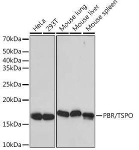 Western blot analysis of extracts of various cell lines, using Anti-PBR Antibody [ARC0308] (A305742) at 1:1000 dilution. The secondary Antibody was Goat Anti-Rabbit IgG H&L Antibody (HRP) at 1:10000 dilution. Lysates/proteins were present at 25 µg per lane