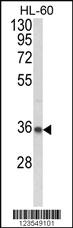 Anti-COL1A1 Rabbit Polyclonal Antibody