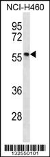 Anti-PHAX Rabbit Polyclonal Antibody