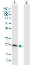 Anti-AHNAK Mouse Polyclonal Antibody