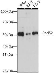 Western blot analysis of extracts of various cell lines, using Anti-RAD52 Antibody [ARC1183] (A308307) at 1:1,000 dilution The secondary antibody was Goat Anti-Rabbit IgG H&L Antibody (HRP) at 1:10,000 dilution Lysates/proteins were present at 25 µg per lane