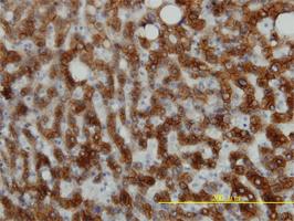 Anti-CK18 Mouse Monoclonal Antibody [clone: 2F8]