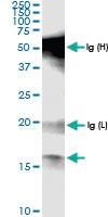 Anti-POLR1D Rabbit Polyclonal Antibody