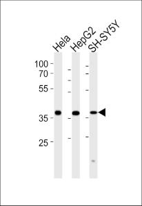 Anti-TIMM50 Rabbit Polyclonal Antibody