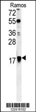 Anti-ARF1 Rabbit Polyclonal Antibody