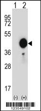 Anti-COL1A1 Rabbit Polyclonal Antibody