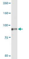 Anti-PFKM Polyclonal Antibody Pair