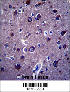 Anti-APP Rabbit Polyclonal Antibody (FITC (Fluorescein Isothiocyanate))