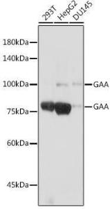 Anti-GAA Rabbit Monoclonal Antibody [clone: ARC2392]