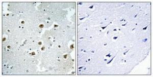 Immunohistochemical analysis of paraffin-embedded human brain using Anti-CAF1B Antibody 1:100 (4 °C overnight). The right hand panel represents a negative control, where the antibody was pre-incubated with the immunising peptide