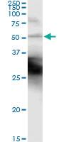 Anti-CK18 Mouse Monoclonal Antibody [clone: 2F8]