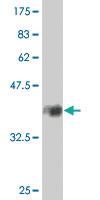 Anti-PDLIM1 Mouse Polyclonal Antibody