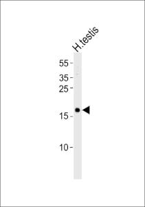 Anti-SPANXA1 Rabbit Polyclonal Antibody