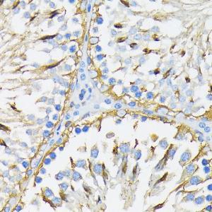 Immunohistochemistry analysis of paraffin-embedded rat testis using Anti-GRP94 Antibody (A12747) at a dilution of 1:200 (40x lens). Perform microwave antigen retrieval with 10 mM PBS buffer pH 7.2 before commencing with IHC staining protocol.