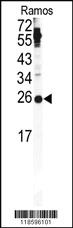 Anti-AMBP Rabbit Polyclonal Antibody