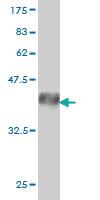 Anti-EPHA3 Mouse Monoclonal Antibody [clone: 3A12]