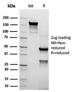 SDS-PAGE analysis of Anti-TROP2 Antibody [rTACSTD2/6395] under non-reduced and reduced conditions; showing intact IgG and intact heavy and light chains, respectively. SDS-PAGE analysis confirms the integrity and purity of the antibody.