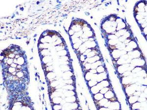 Immunohistochemistry analysis of paraffin-embedded human colon tissue using Anti-PBR Antibody [ARC0308] (A305742) at a dilution of 1:100 (40X lens). Perform microwave antigen retrieval with 10 mM PBS buffer pH 7.2 before commencing with IHC staining protocol