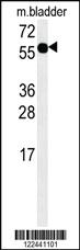 Anti-ADSSL1 Rabbit Polyclonal Antibody