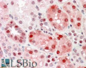 EB08317 (3.8 µg/ml) staining of paraffin embedded Human Kidney. Steamed antigen retrieval with citrate buffer pH 6, AP-staining.