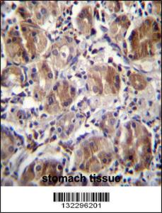 Anti-CTDNEP1 Rabbit Polyclonal Antibody (Biotin)