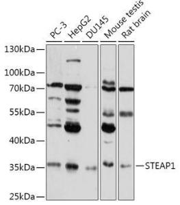 Western blot analysis of extracts of various cell lines, using Anti-STEAP1 Antibody (A307293) at 1:1000 dilution. The secondary Antibody was Goat Anti-Rabbit IgG H&L Antibody (HRP) at 1:10000 dilution. Lysates/proteins were present at 25 µg per lane