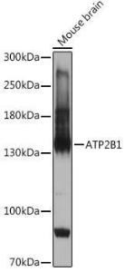 Anti-PMCA1 Rabbit Polyclonal Antibody