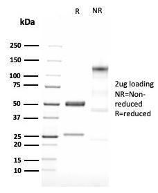 Anti-LMO2 Rabbit Recombinant Antibody [clone: LMO2/3147R]