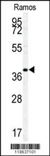 Anti-PPP2CB Rabbit Polyclonal Antibody