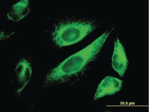 Anti-CK18 Mouse Monoclonal Antibody [clone: 2F8]