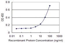 Anti-ADAM30 Mouse Monoclonal Antibody [clone: 3E5]