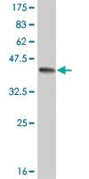 Anti-EPHA3 Mouse Monoclonal Antibody [clone: 3E9]