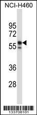 Anti-KRT6B Rabbit Polyclonal Antibody (AP (Alkaline Phosphatase))