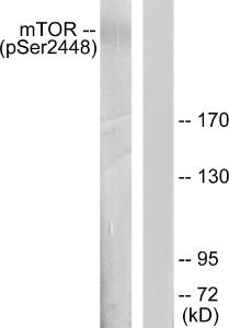 Western blot analysis of lysates from HeLa cells treated with EGF 200ng/ml 30' using Anti-mTOR (phospho Ser2448) Antibody. The right hand lane represents a negative control, where the antibody is blocked by the immunising peptide.