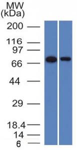 Western blot analysis of HeLa and A431 cell lysates using Anti-CD105 Antibody [ENG/1327]