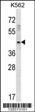 Anti-DOC2A Rabbit Polyclonal Antibody