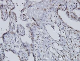 Anti-NOCT Mouse Monoclonal Antibody [clone: 3E8]