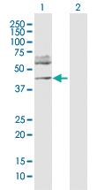 Anti-FOXP3 Rabbit Polyclonal Antibody