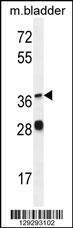 Anti-FADS6 Rabbit Polyclonal Antibody (PE (Phycoerythrin))