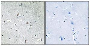 Immunohistochemical analysis of paraffin-embedded human brain using Anti-mTOR (phospho Ser2448) Antibody. The right hand panel represents a negative control, where the antibody was pre-incubated with the immunising peptide.