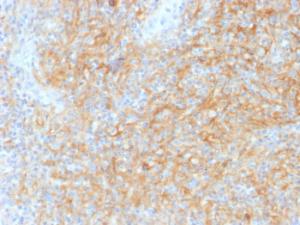 Anti-CD40 Mouse Monoclonal Antibody [Clone: C40/1605]